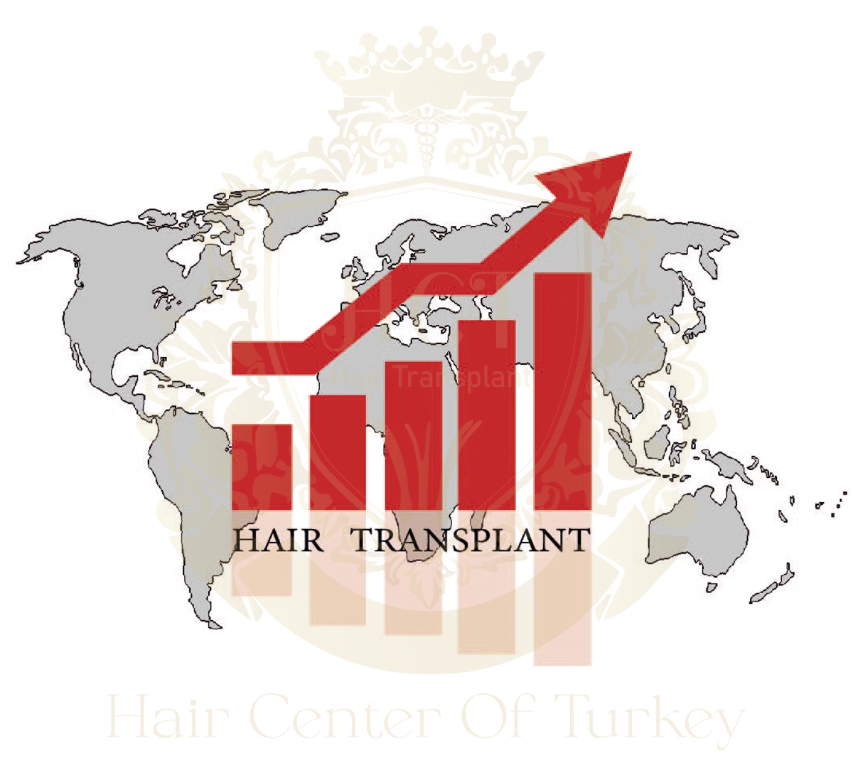Hair Transplant Costs İn Turkey